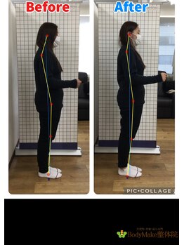 ボディメイク整体院 横浜駅西口店(BodyMake)/施術風景-首が辛い女子大生-