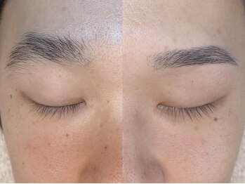 アドア(adore)の写真/眉毛にお悩みをお持ちの方にオススメ◎骨格に合わせたデザインをご提案