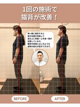 スペックフィジカルコンディショニング(SPECフィジカルコンディショニング)/40代女性/姿勢ビフォーアフター