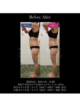 サロン ダリア(Salon Dahlia)/全身痩身