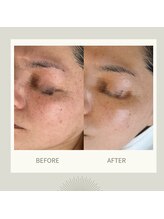 イルガドット 897(ilga.897)