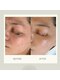 イルガドット 897(ilga.897)の写真/【韓国女優のような艶のある水光肌へ◇】自分至上輝きのあるお肌に♪お肌のお悩みお気軽にご相談ください。