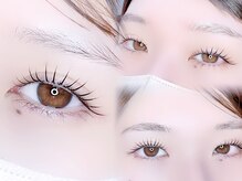 しっかりとカウンセリングを行います◎