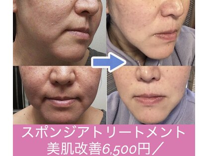 セイ セイ コライユ(整 sei corail)の写真