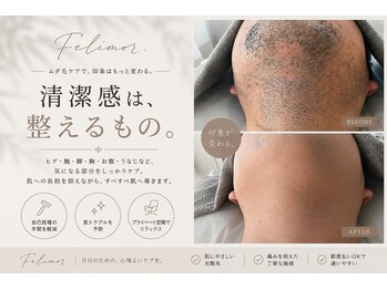 フェリモール(Felimor.)の写真/「脱毛する」より「ラクになる」