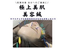 ハリナチュレ 那覇店(HARINATURE)/極上美肌美容鍼