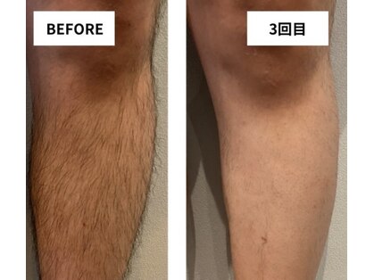 エステティック バイ イム(esthetic by im)の写真