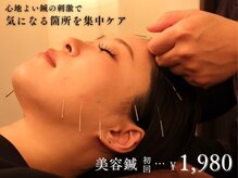 コハルはり灸整骨院(koharuはり灸整骨院)
