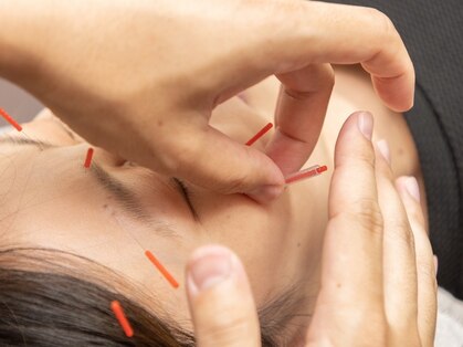 紬はりきゅう接骨院の写真