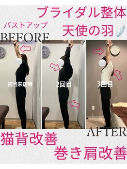 ユルル 刈谷店(Yururu)/ビフォーアフター(猫背整体)