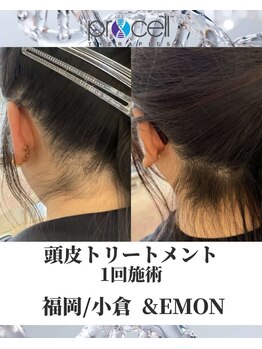 アンドエモン(&EMON)/【頭皮】プロセル効果