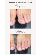 ノウェム(nove'M)/foot special care