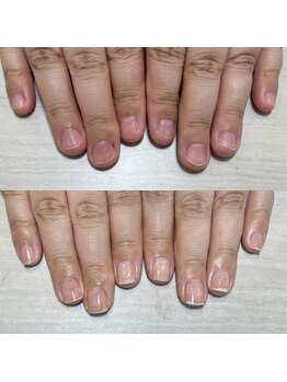 ロイ 初生店(LOI)/自爪育成3ヵ月コース