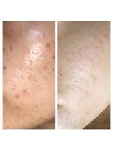 マノ(mano)/つやつやお肌に