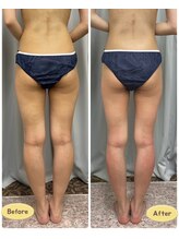 FJ/脂肪撃退！下半身痩せ◆