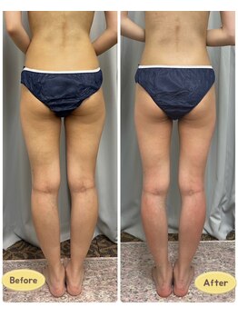 FJ/脂肪撃退!下半身痩せ◆