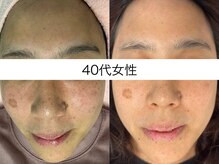 サクラ 本厚木駅前店(SAKURA)/30代後半　3回目