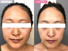 アイラッシュ リップル(Eyelash ripplu)/フェイシャルエステ