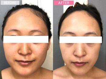 アイラッシュ リップル(Eyelash ripplu)/フェイシャルエステ