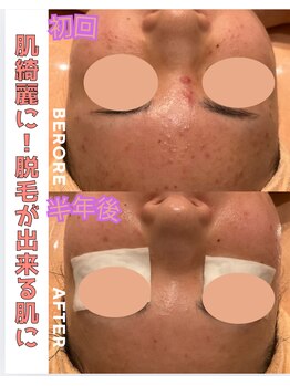 パルティノ 高崎店/症例