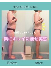 スリムライク 鳥取店(The SLIM LIKE)/痩身ビフォーアフター