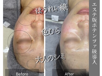 グロウ(glow.)の写真