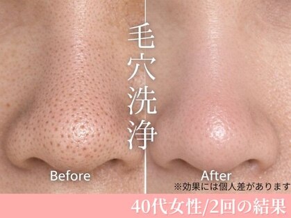 ルージュ(CP Rouge)の写真