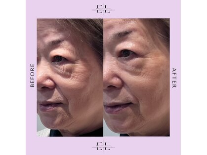 アグラン ヴィラ スイタ(a Gland villa SUITA)の写真