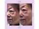 アグラン ヴィラ スイタ(a Gland villa SUITA)の写真