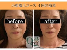 キュープ 表参道店(Qpu)/続けた方しか感じられない変化♪