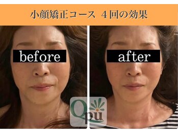 キュープ 表参道店(Qpu)/続けた方しか感じられない変化♪