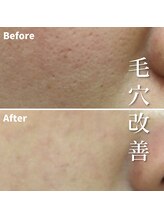 ファシー 四日市(fachi.)/陶肌トリートメント