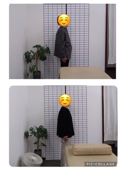 ことぶき整骨院/姿勢改善