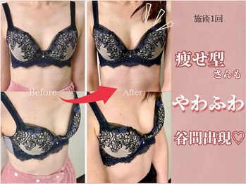 メデル(MEDEL)/ビフォーアフター