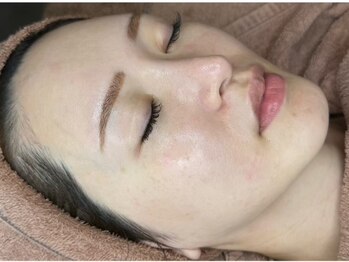 シアピール(CIA PEEL)の写真/肌悩み別の2種類のピーリングが毛穴を撲滅!!詰まり/開き/角質/黒ずみを解消して自信が持てる韓国艶肌へ★