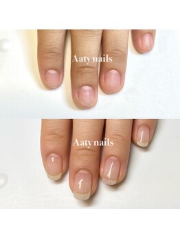 アーティネイルズ(Aaty Nails)/補強しながら爪を強く育てていく
