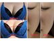 ボヌールの写真