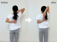 エーアール(AR)/【Before/After】5回目