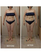 らたす(Ra+)/痩身全身コース 前