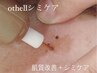 【徹底集中!!シミケア】美白シミケア《ショートコース》 12,000円