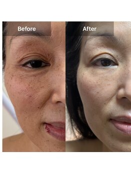 サロン ド アヤ(salon de Aya)/来店一年半（月一回）黄金比顔