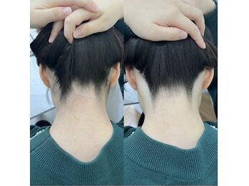 ミース 江坂店/うなじ●ビフォーアフター江坂店