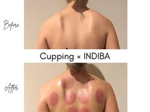 レア(Le'a)の雰囲気（【カッピングセラピ－】1月新クーポン登場！！）