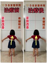 うるま整体院/骨盤矯正