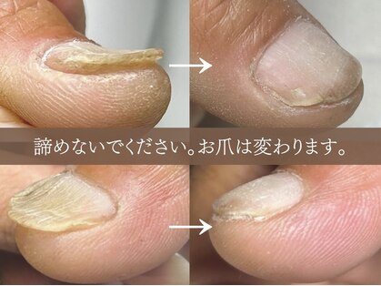 アーク(arc)の写真