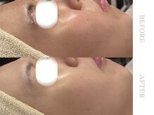 ソワ 恵比寿(soi)/ENVIRONエンビロンフルコース