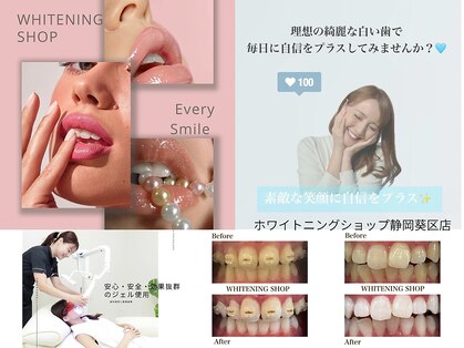 ホワイトニングショップ 葵区静岡駅店の写真