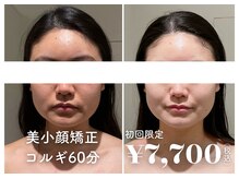 イデアルミー 大宮店(イデアルMe)の雰囲気（小顔ケア・毛穴ケア・ハーブピーリングが大人気!!）