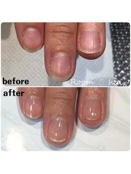 ルームヘアネイル 曙橋店(Room hair nail)/ケア ビフォーアフター