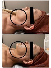 ラヴィエ ベル(La vie est belle)/50代！気になる顎下のお肉！